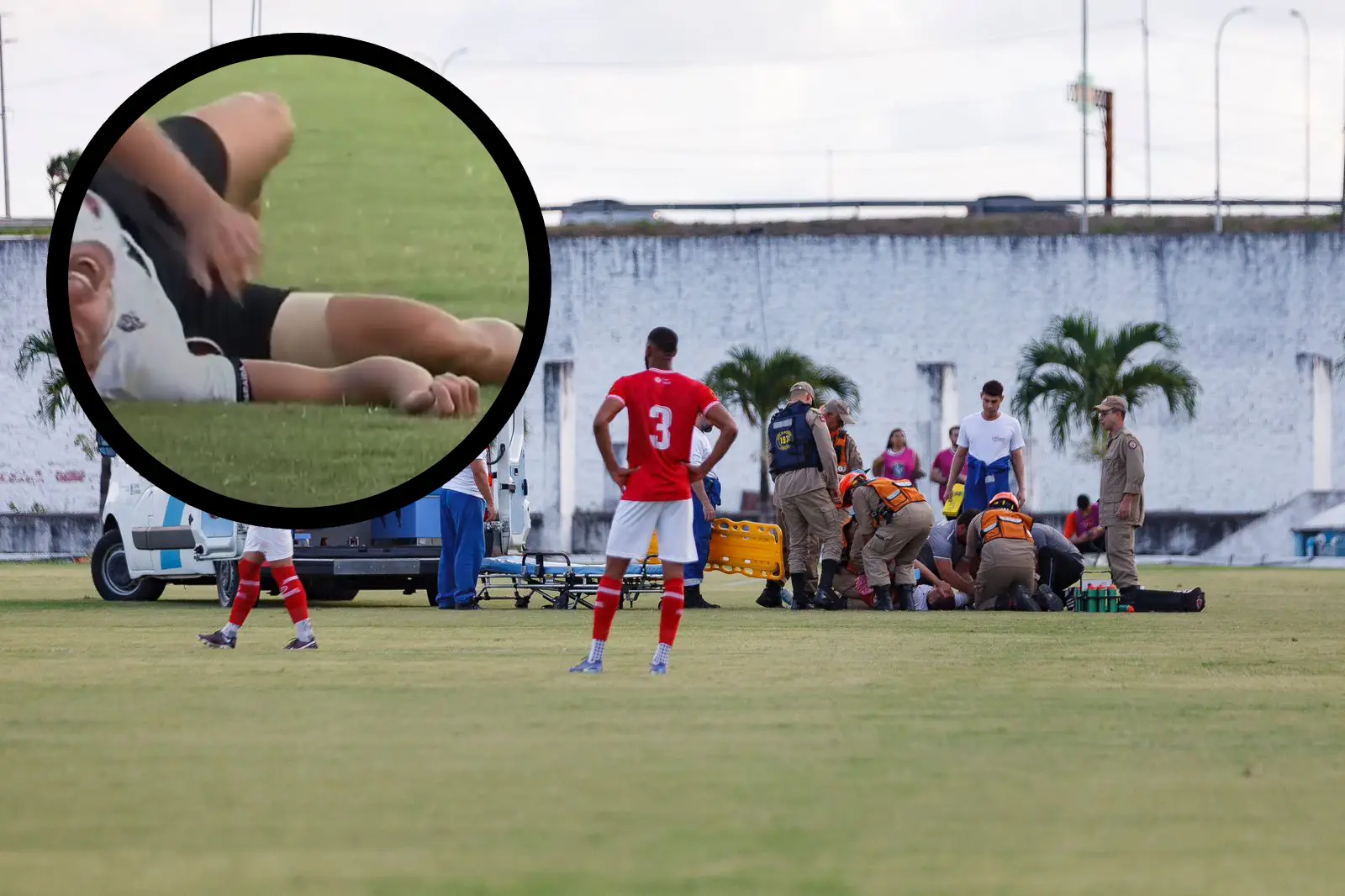 Igor Maduro, do Botafogo-PB, sofre grave lesão em clássico contra o Auto Esporte
