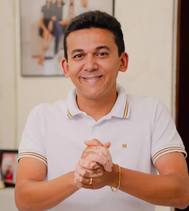 Prefeito de Santa Rita, Jackson Alvino - Foto: Reprodução